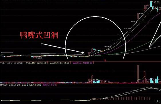 鴨嘴式凹洞